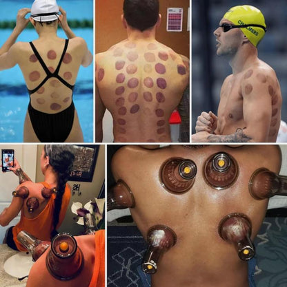 Cupping Kit Massage Therapy