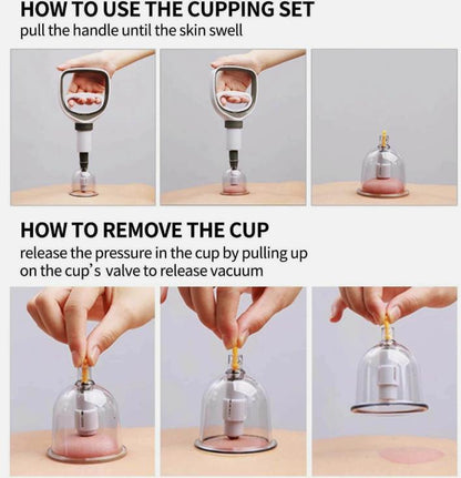 Cupping Kit Massage Therapy